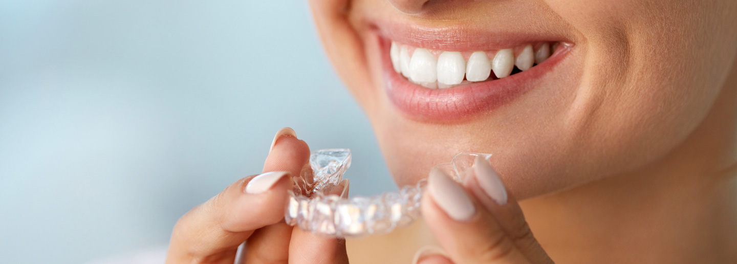 Top 5 Invisalign Secrets from Breslau Providers