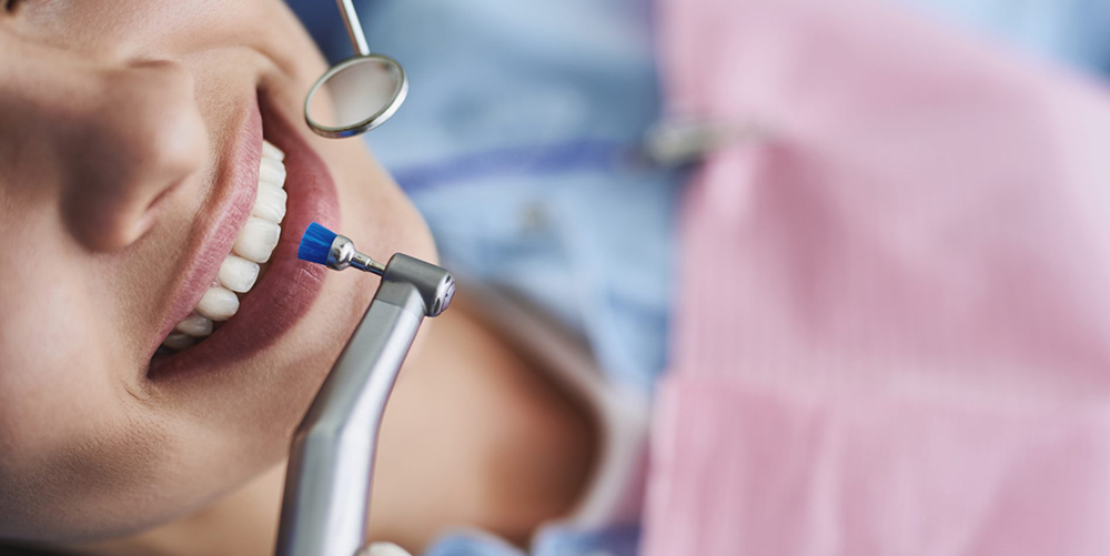 Dental Cleaning Kitchener Waterloo