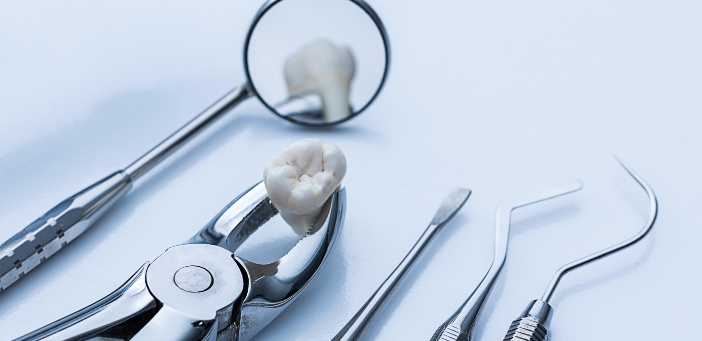 dental-extractions-kitchener-waterloo