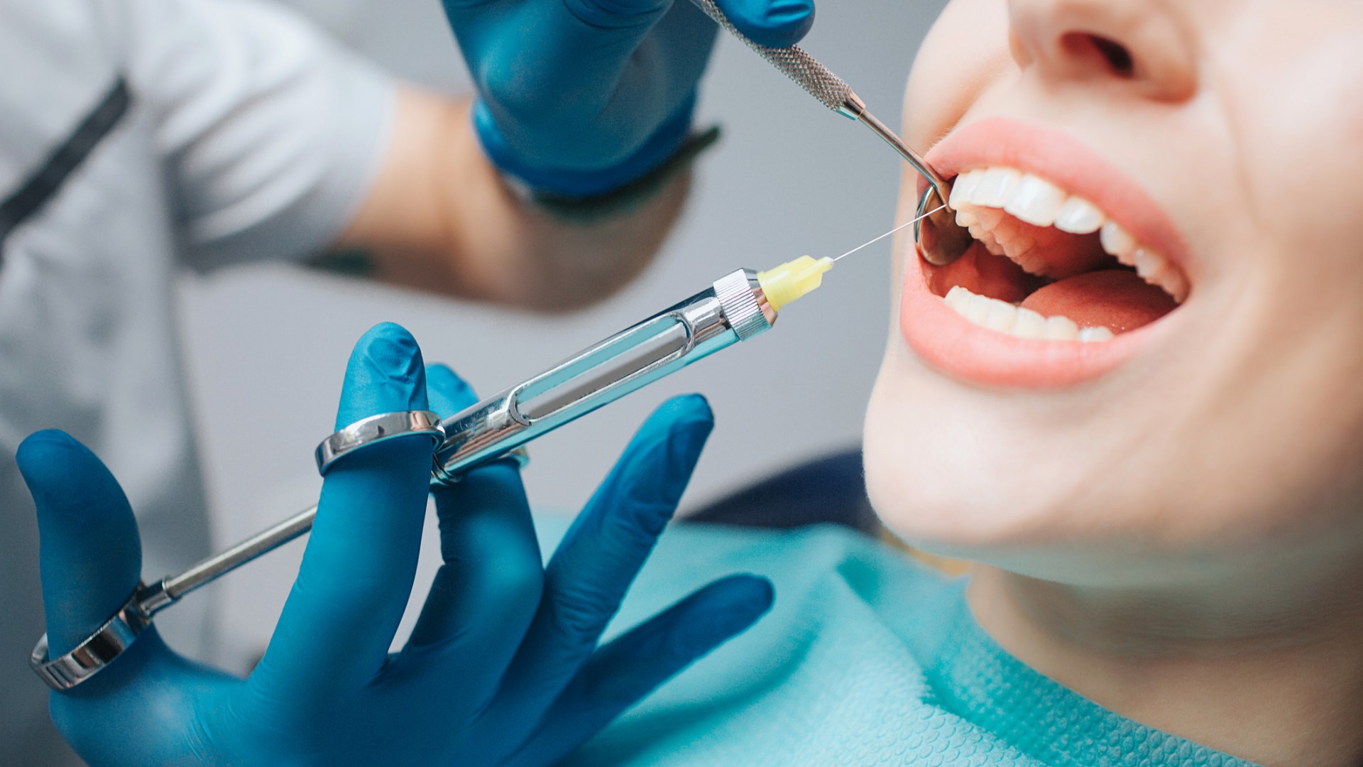 dental-fillings-breslau