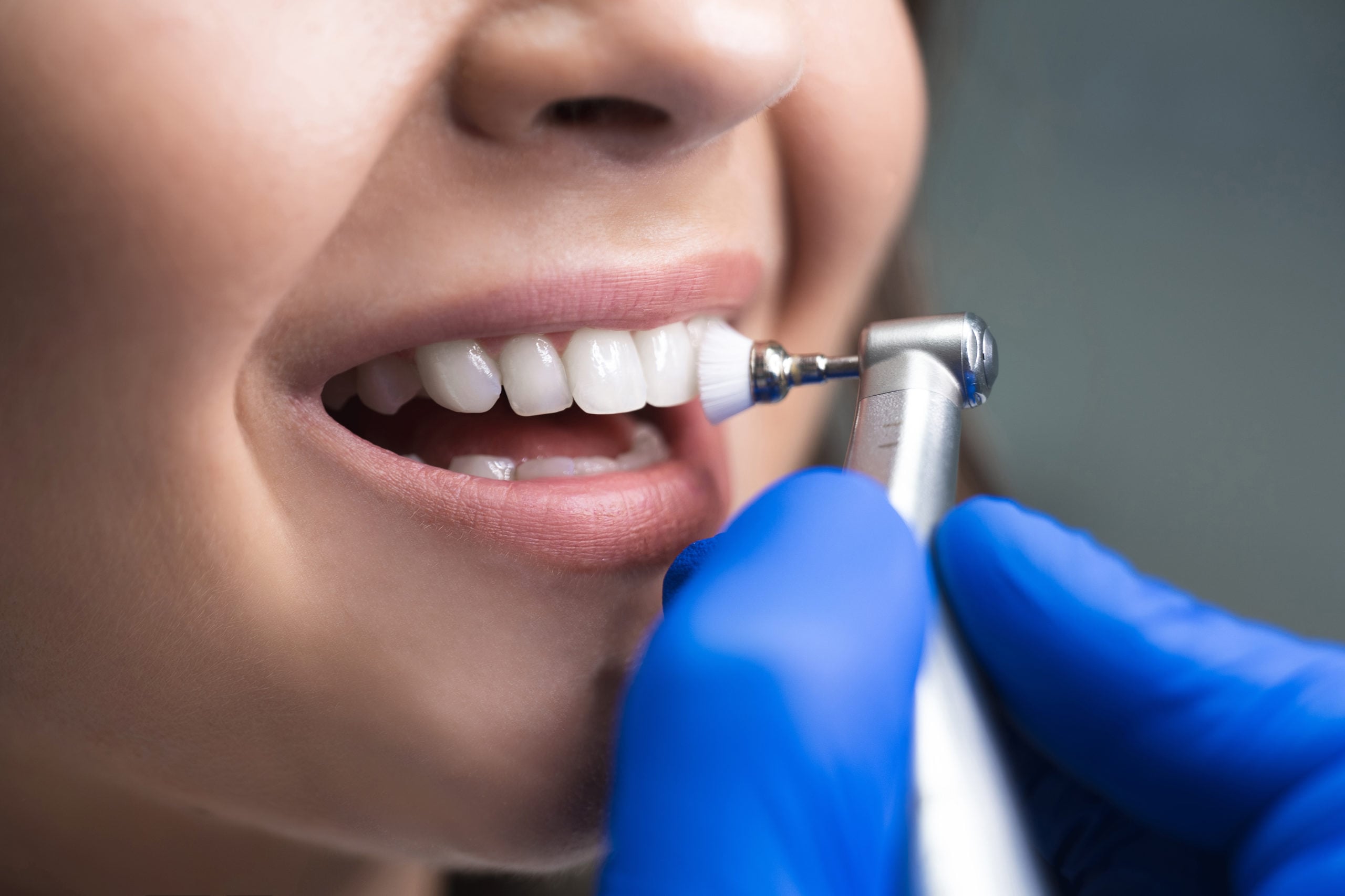 Why Regular Dental Check Up Waterloo Matter For Your Health